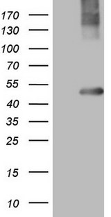 MTOR Antibody - Human recombinant protein fragment corresponding to amino acids 1766-2144 of human MTOR(NP_004949) produced in E.coli.