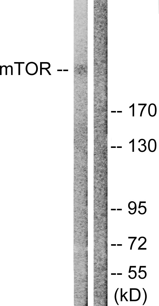 MTOR Antibody - Western blot analysis of lysates from NIH/3T3 cells, treated with Insulin 0.01U/ml 15', using mTOR Antibody. The lane on the right is blocked with the synthesized peptide.