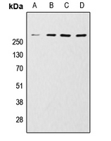 MTOR Antibody - Western blot analysis of mTOR expression in HeLa (A); MCF7 (B); Jurkat (C); A431 (D) whole cell lysates.