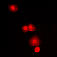 MTOR Antibody - Immunofluorescent analysis of mTOR staining in MCF7 cells. Formalin-fixed cells were permeabilized with 0.1% Triton X-100 in TBS for 5-10 minutes and blocked with 3% BSA-PBS for 30 minutes at room temperature. Cells were probed with the primary antibody in 3% BSA-PBS and incubated overnight at 4 C in a humidified chamber. Cells were washed with PBST and incubated with a DyLight 594-conjugated secondary antibody (red) in PBS at room temperature in the dark. DAPI was used to stain the cell nuclei (blue).