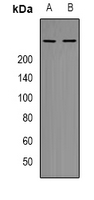 MTOR Antibody - Western blot analysis of mTOR (pT2446) expression in HeLa (A); NIH3T3 (B) whole cell lysates.