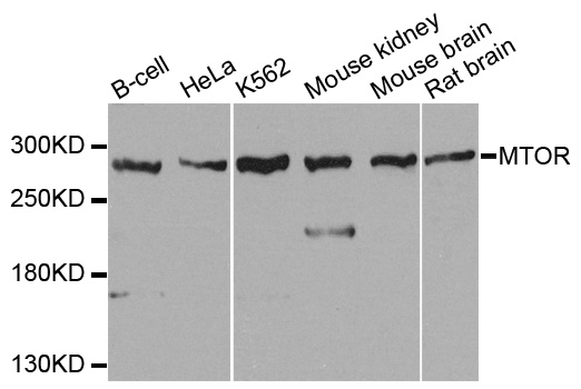 MTOR Antibody - Western blot analysis of extracts of various cell lines.