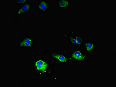 MTOR Antibody - Immunofluorescent analysis of Hela cells diluted at 1:100 and Alexa Fluor 488-congugated AffiniPure Goat Anti-Rabbit IgG(H+L)