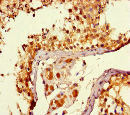 MTOR Antibody - Immunohistochemistry of paraffin-embedded human testis tissue at dilution of 1:100