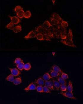 MTOR Antibody - Immunofluorescence analysis of HeLa cells using MTOR antibody at dilution of 1:100. Blue: DAPI for nuclear staining.