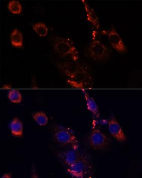 MTOR Antibody - Immunofluorescence analysis of NIH/3T3 cells using MTOR antibody at dilution of 1:100. Blue: DAPI for nuclear staining.