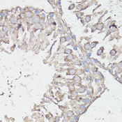 MTOR Antibody - Immunohistochemistry of paraffin-embedded rat testis using MTOR antibody at dilution of 1:100 (40x lens).
