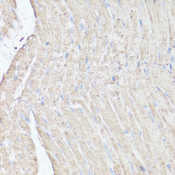 MTOR Antibody - Immunohistochemistry of paraffin-embedded mouse heart using MTOR antibody at dilution of 1:100 (40x lens).