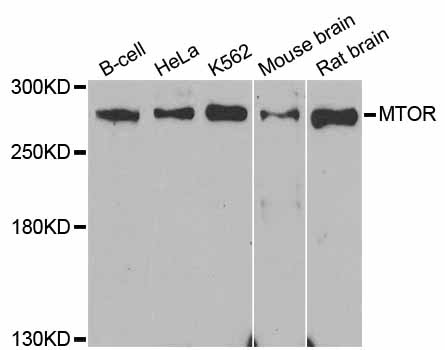 MTOR Antibody - Western blot analysis of extracts of various cell lines, using MTOR antibody at 1:1000 dilution. The secondary antibody used was an HRP Goat Anti-Rabbit IgG (H+L) at 1:10000 dilution. Lysates were loaded 25ug per lane and 3% nonfat dry milk in TBST was used for blocking. An ECL Kit was used for detection and the exposure time was 90s.