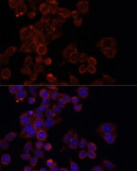 MTOR Antibody - Immunofluorescence analysis of HeLa cells using mTOR antibody at dilution of 1:100. Blue: DAPI for nuclear staining.