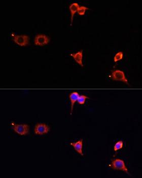 MTOR Antibody - Immunofluorescence analysis of PC12 cells using mTOR antibody at dilution of 1:100. Blue: DAPI for nuclear staining.