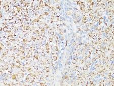 MTOR Antibody - Immunohistochemistry of paraffin-embedded rat ovary using mTOR antibody at dilution of 1:150 (40x lens).
