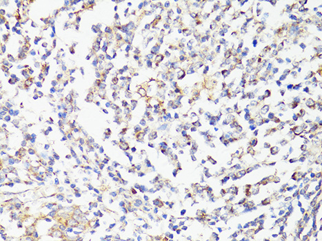 MTOR Antibody - Immunohistochemistry of paraffin-embedded human tonsil using mTOR antibody at dilution of 1:150 (40x lens).