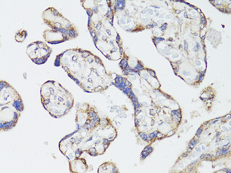 MTOR Antibody - Immunohistochemistry of paraffin-embedded human placenta using mTOR antibody at dilution of 1:150 (40x lens).