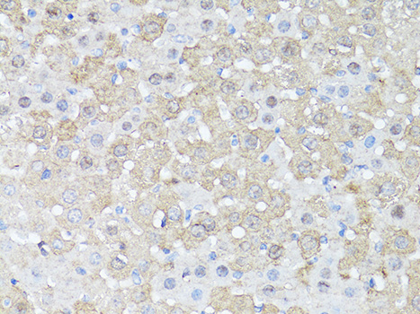 MTOR Antibody - Immunohistochemistry of paraffin-embedded mouse liver using mTOR antibody at dilution of 1:150 (40x lens).