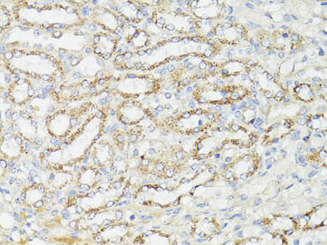 MTOR Antibody - Immunohistochemistry of paraffin-embedded mouse kidney using mTOR antibody at dilution of 1:150 (40x lens).