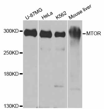 MTOR Antibody - Western blot analysis of extracts of various cell lines, using mTOR antibody at 1:1000 dilution. The secondary antibody used was an HRP Goat Anti-Rabbit IgG (H+L) at 1:10000 dilution. Lysates were loaded 25ug per lane and 3% nonfat dry milk in TBST was used for blocking. An ECL Kit was used for detection and the exposure time was 30s.