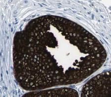MTOR Antibody - mTOR antibody for IHC in human prostate tissue