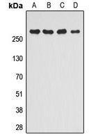 MTOR Antibody - Western blot analysis of mTOR (pS2448) expression in HEK293T PMA-treated (A); HeLa (B); RAW264.7 PMA-treated (C); mouse liver (D) whole cell lysates.