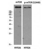 MTOR Antibody - Western blot of Phospho-mTOR (S2448) antibody