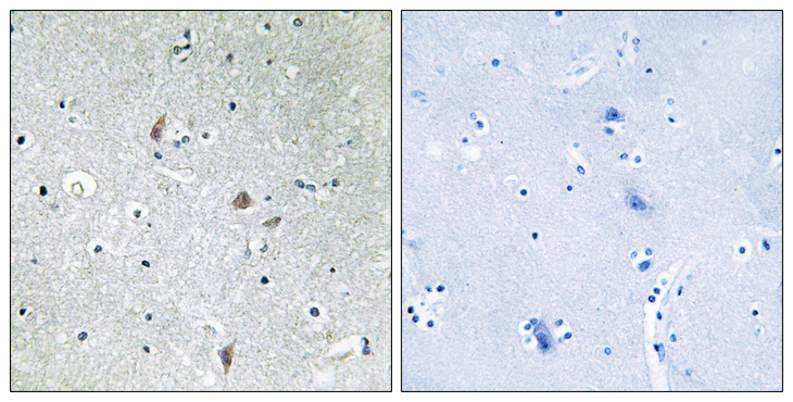 MTOR Antibody - Immunohistochemistry analysis of paraffin-embedded human brain, using mTOR (Phospho-Ser2448) Antibody. The picture on the right is blocked with the phospho peptide.