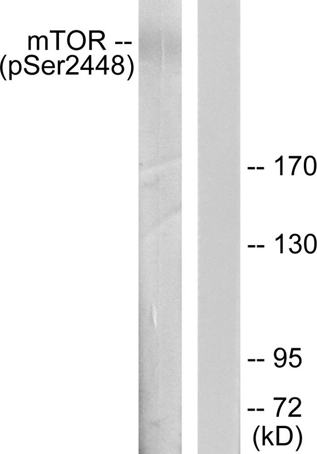 MTOR Antibody - Western blot analysis of lysates from HeLa cells treated with EGF 200ng/ml 30', using mTOR (Phospho-Ser2448) Antibody. The lane on the right is blocked with the phospho peptide.