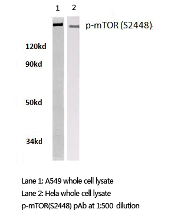 MTOR Antibody - Western blot of p-mTOR (S2448) pAb in extracts from A549 and HeLa cells.