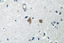 MTOR Antibody - IHC of p-mTOR (S2448) pAb in paraffin-embedded human brain tissue.