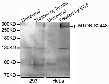 MTOR Antibody - Western blot analysis of extracts of various cells.