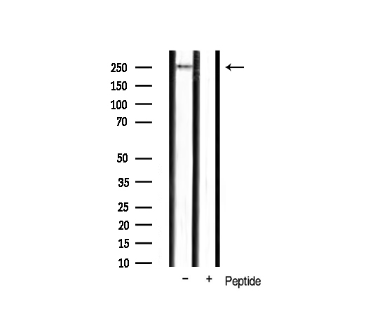 MTOR Antibody - Western blot analysis of mTOR phosphorylation expression in mouse liver tissue lysates. The lane on the right is treated with the antigen-specific peptide.