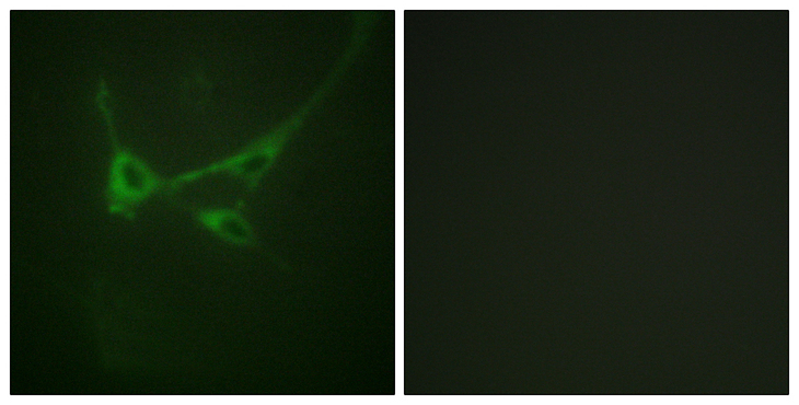 MTOR Antibody - Immunofluorescence analysis of NIH/3T3 cells, using mTOR (Phospho-Ser2481) Antibody. The picture on the right is blocked with the phospho peptide.