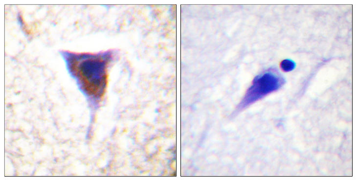 MTOR Antibody - Immunohistochemistry analysis of paraffin-embedded human brain, using mTOR (Phospho-Ser2481) Antibody. The picture on the right is blocked with the phospho peptide.