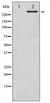 MTOR Antibody - Western blot of mTOR phosphorylation expression in HeLa whole cell lysates,The lane on the left is treated with the antigen-specific peptide.