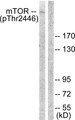 MTOR Antibody - Western blot analysis of lysates from NIH/3T3 cells treated with Insulin 0.01U/ml 15', using mTOR (Phospho-Thr2446) Antibody. The lane on the right is blocked with the phospho peptide.