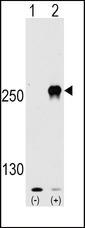 MTOR Antibody - Western blot of FRAP1 (arrow) using rabbit polyclonal FRAP1 Antibody (S2481). 293 cell lysates (2 ug/lane) either nontransfected (Lane 1) or transiently transfected with the FRAP1 gene (Lane 2) (Origene Technologies).