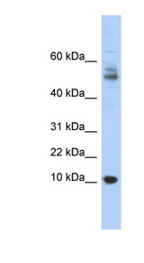 MTPN / Myotrophin Antibody - MTPN antibody Western blot of Fetal Thymus lysate. This image was taken for the unconjugated form of this product. Other forms have not been tested.