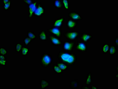 MTRF1 Antibody - Immunofluorescence staining of Hela cells with MTRF1 Antibody at 1:100, counter-stained with DAPI. The cells were fixed in 4% formaldehyde, permeabilized using 0.2% Triton X-100 and blocked in 10% normal Goat Serum. The cells were then incubated with the antibody overnight at 4°C. The secondary antibody was Alexa Fluor 488-congugated AffiniPure Goat Anti-Rabbit IgG(H+L).