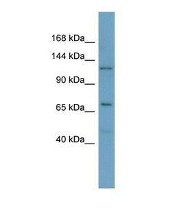 MTRPOL / POLRMT Antibody - Western blot of Human OVCAR-3. POLRMT antibody dilution 1.0 ug/ml.  This image was taken for the unconjugated form of this product. Other forms have not been tested.