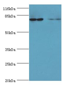 MTRR Antibody - Western blot. All lanes: MTRR antibody at 2 ug/ml Lane 1:PC-3 whole cell lysate. Lane 2: HepG2 whole cell lysate. Secondary antibody: Goat polyclonal to rabbit at 1:10000 dilution. Predicted band size: 80 kDa. Observed band size: 80 kDa.  This image was taken for the unconjugated form of this product. Other forms have not been tested.
