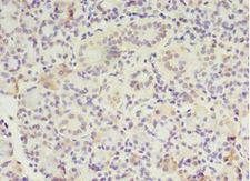 MTRR Antibody - Immunohistochemistry of paraffin-embedded human pancreas tissue using antibody at 1:100 dilution.  This image was taken for the unconjugated form of this product. Other forms have not been tested.