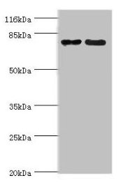 MTRR Antibody - Western blot All lanes: MTRR antibody at 2µg/ml Lane 1: PC-3 whole cell lysate Lane 2: HepG2 whole cell lysate Secondary Goat polyclonal to rabbit IgG at 1/10000 dilution Predicted band size: 81, 78, 7 kDa Observed band size: 81 kDa