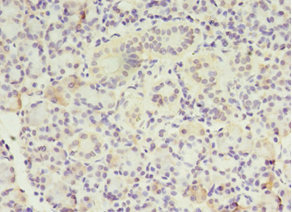 MTRR Antibody - Immunohistochemistry of paraffin-embedded human pancreatic tissue using MTRR Antibody at dilution of 1:100