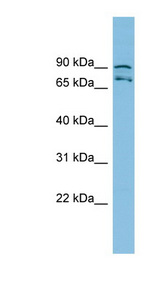 MTRR Antibody - MTRR antibody Western blot of HepG2 cell lysate. This image was taken for the unconjugated form of this product. Other forms have not been tested.