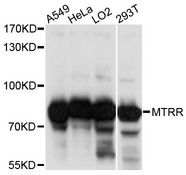 MTRR Antibody - Western blot analysis of extracts of various cell lines, using MTRR antibody at 1:1000 dilution. The secondary antibody used was an HRP Goat Anti-Rabbit IgG (H+L) at 1:10000 dilution. Lysates were loaded 25ug per lane and 3% nonfat dry milk in TBST was used for blocking. An ECL Kit was used for detection and the exposure time was 20s.