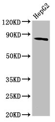 MTSS1 / MIM Antibody - Western Blot Positive WB detected in: HepG2 whole cell lysate All Lanes: MTSS1 antibody at 3.84µg/ml Secondary Goat polyclonal to rabbit IgG at 1/50000 dilution Predicted band size: 83, 51, 80 KDa Observed band size: 83 KDa