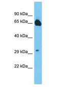 MTSS1L Antibody - MTSS1L antibody Western Blot of OVCAR-3. Antibody dilution: 1 ug/ml.  This image was taken for the unconjugated form of this product. Other forms have not been tested.