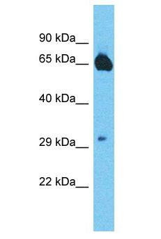 MTSS1L Antibody - MTSS1L antibody Western Blot of OVCAR-3. Antibody dilution: 1 ug/ml.  This image was taken for the unconjugated form of this product. Other forms have not been tested.