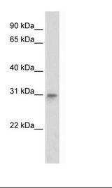 MtTFA / TFAM Antibody - NIH 3T3 Cell Lysate.  This image was taken for the unconjugated form of this product. Other forms have not been tested.