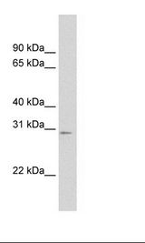 MtTFA / TFAM Antibody - SP2/0 Cell Lysate.  This image was taken for the unconjugated form of this product. Other forms have not been tested.