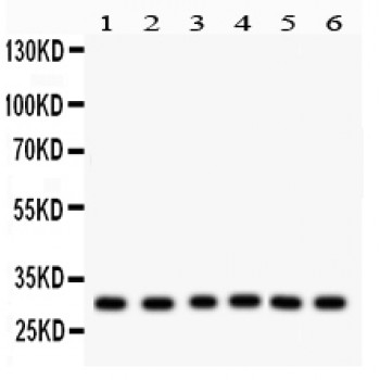 MtTFA / TFAM Antibody - mtTFA antibody Western blot. All lanes: Anti mtTFA at 0.5 ug/ml. Lane 1: Rat Brain Tissue Lysate at 50 ug. Lane 2: HEPA Whole Cell Lysate at 40 ug. Lane 3: Human Placenta Tissue Lysate at 50 ug. Lane 4: HELA Whole Cell Lysate at 40 ug. Lane 5: HEPG2 Whole Cell Lysate at 40 ug. Lane 6: COLO320 Whole Cell Lysate at 40 ug. Predicted band size: 29 kD. Observed band size: 29 kD.